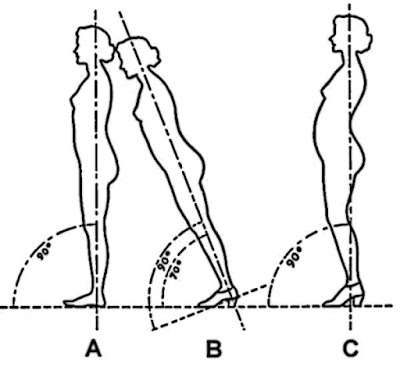 Ecco perché in molti soffriamo di dolori ai piedi e alle gambe (e non solo) 3